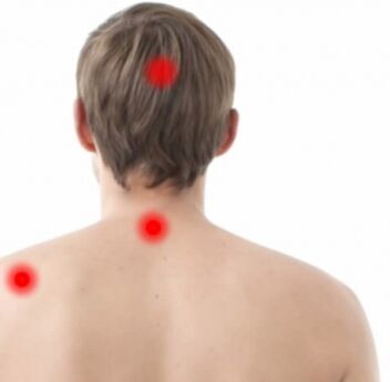 Žarišča osteohondroze