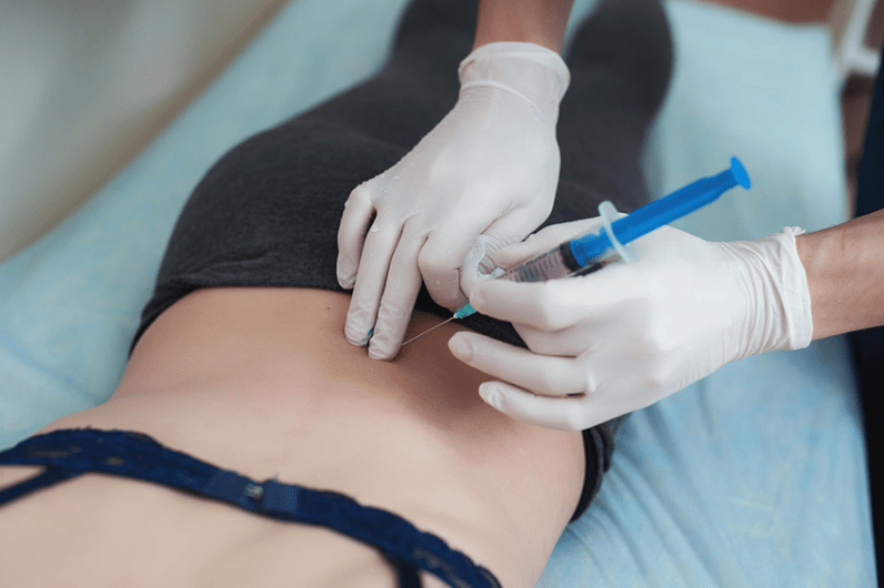 blokada pri ledveni osteohondrozi